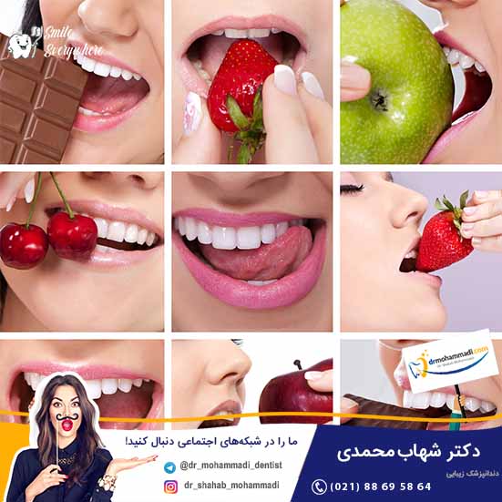 طول عمر کامپوزیت دندان چقدر است؟ - کلینیک دندانپزشکی دکتر شهاب محمدی